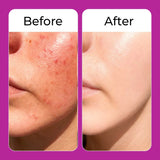 glutathione for skin